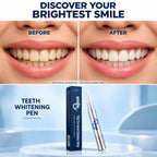 Before and after smile comparison using Smile Dew peroxide-free teeth whitening pen, individual results vary.