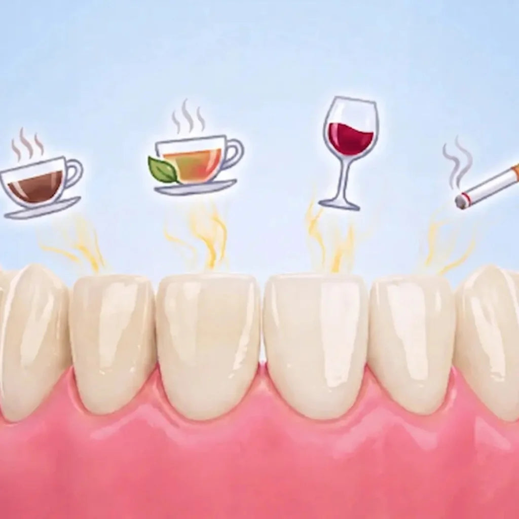 Illustration: everyday surface stains from coffee, tea, wine and smoking