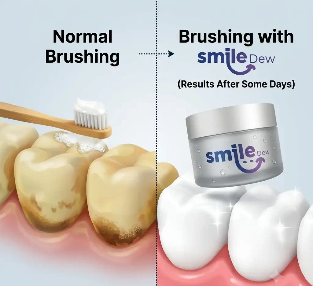 Before and after comparison: normal brushing versus brushing with Smile Dew teeth whitening powder